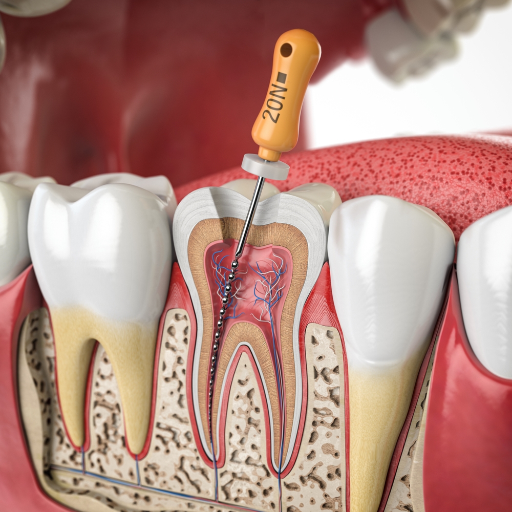 Home Page Endodontics Brownsville