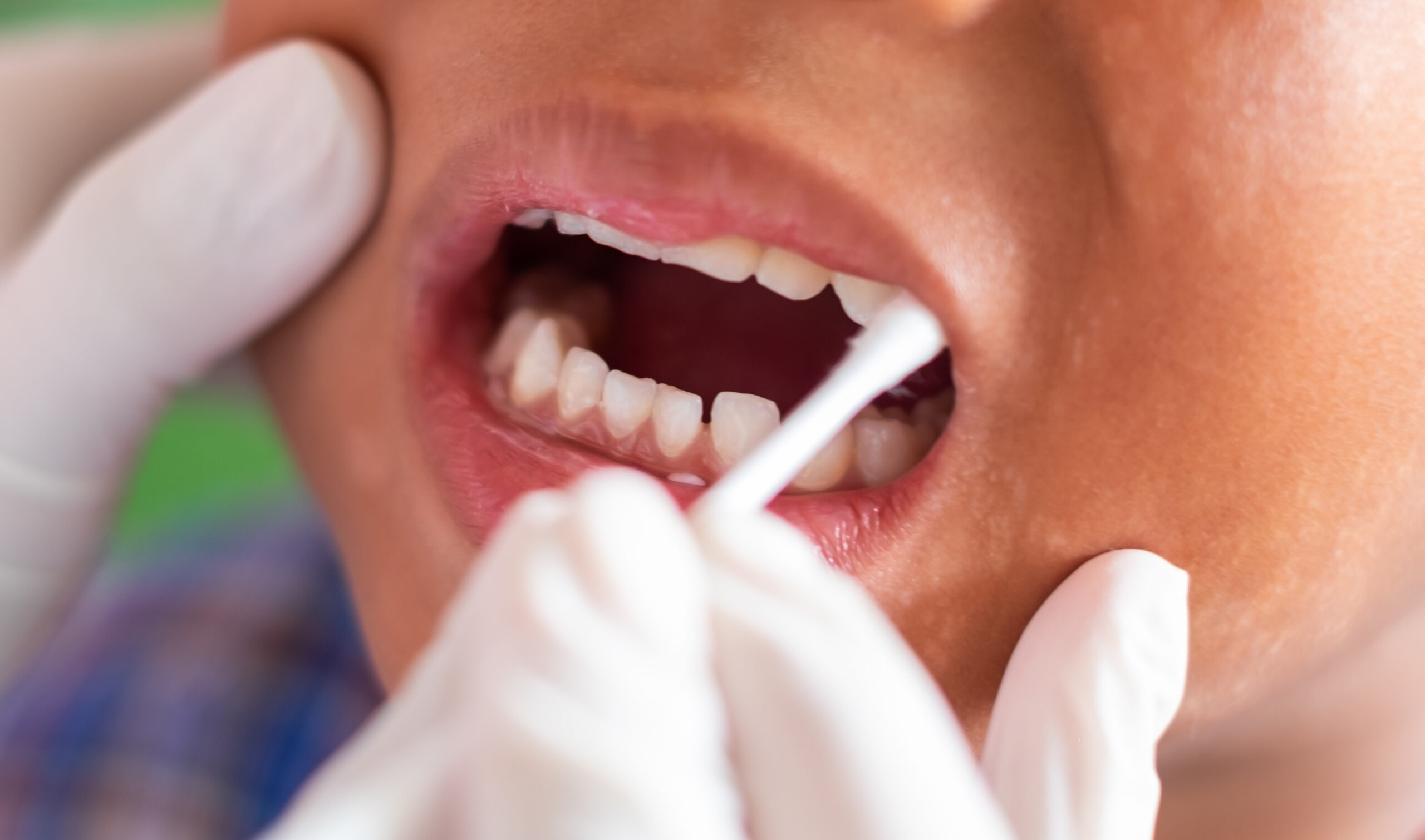 Fluoride Brownsville